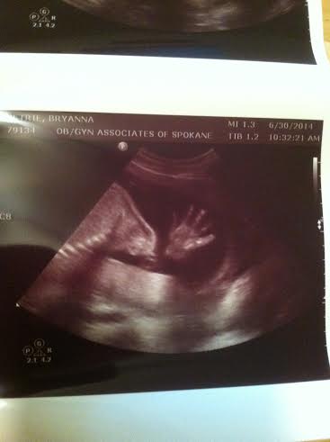 baby's hand at 23 weeks 3 days