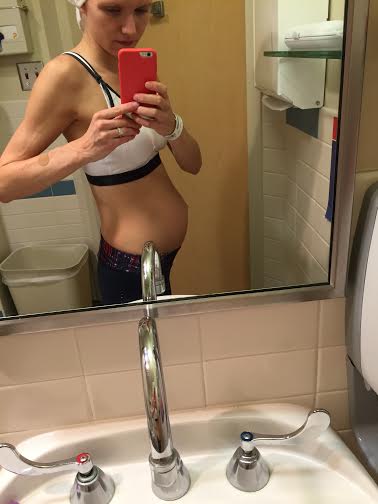 1 day postpartum 20th