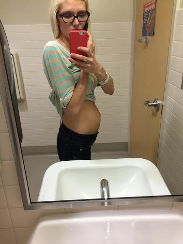 1 week postpartum 24