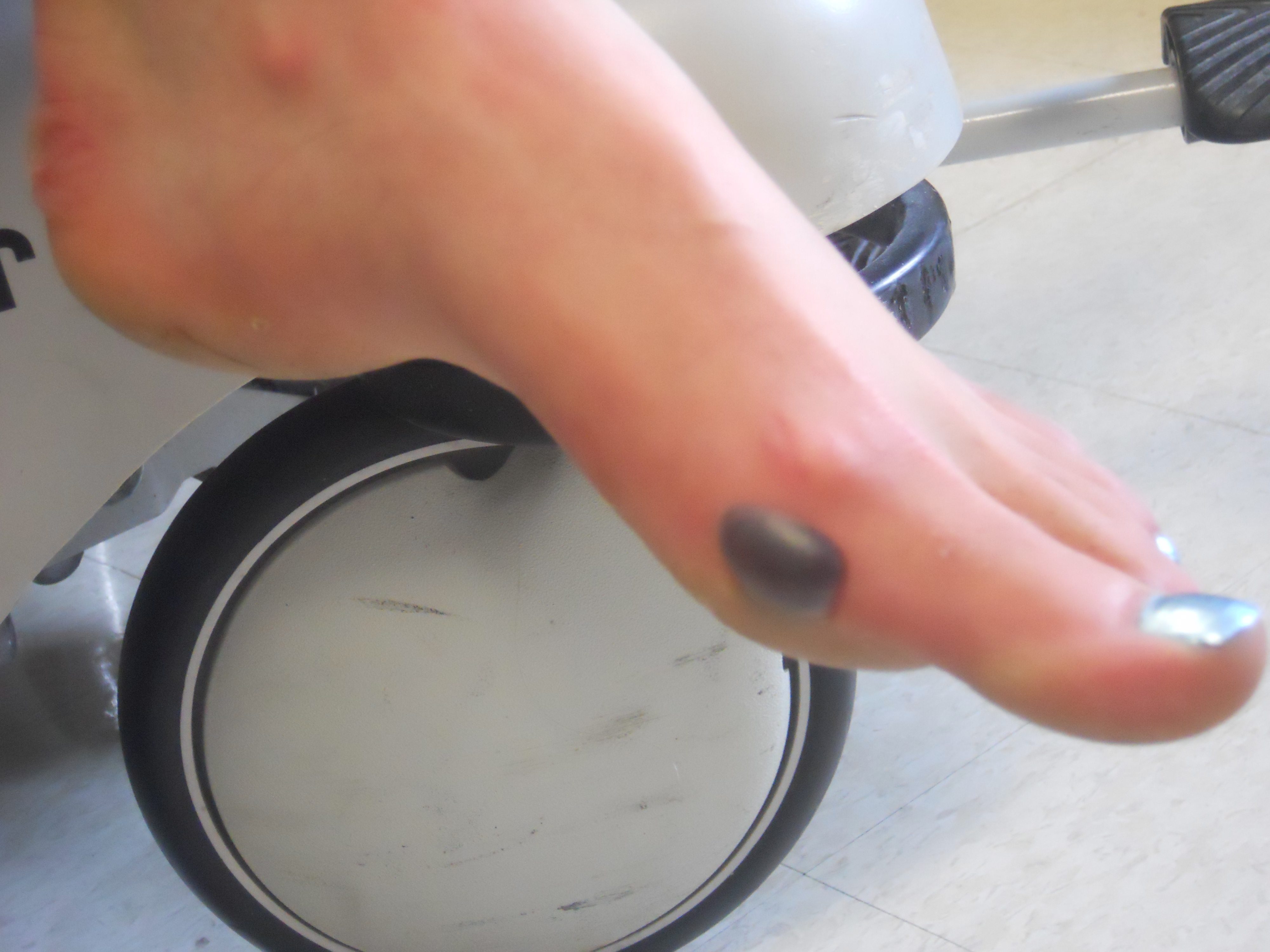 blister