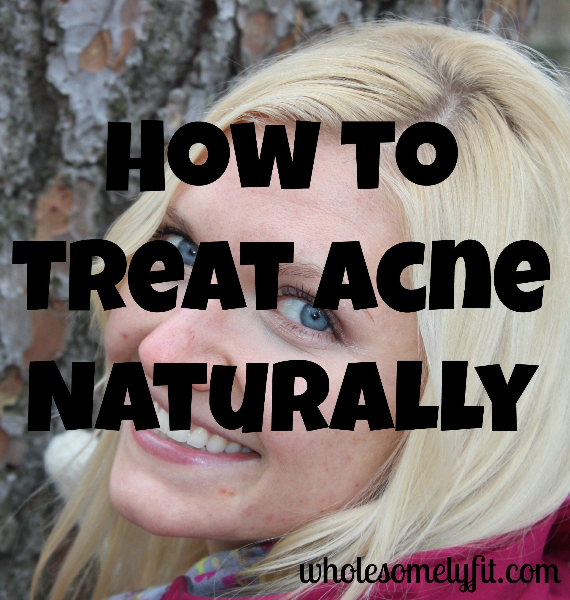 How to treat acne naturally