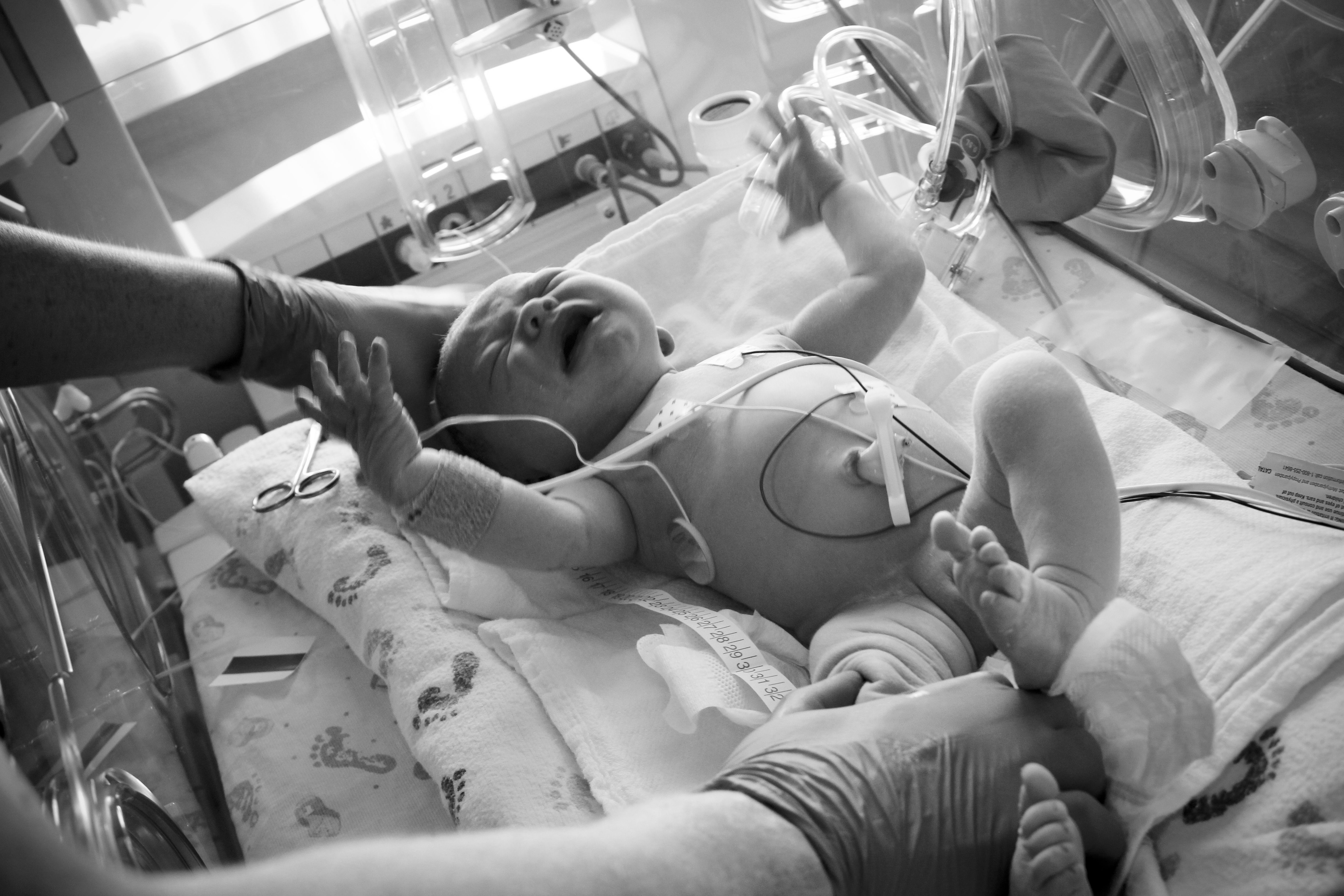 Post Labor-Bean Getting Measured B&W